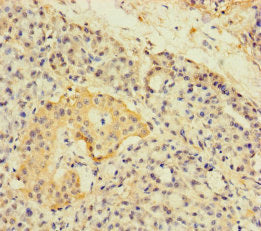 A4Gnt Polyclonal Antibody - image 3
