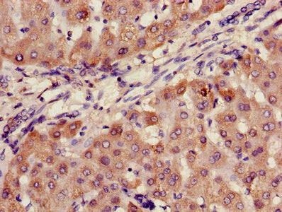 Aadac Polyclonal Antibody - image 3