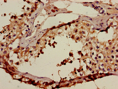 Acrv1 Polyclonal Antibody - image 2