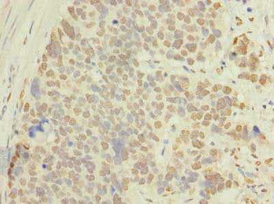 Immunohistochemistry of paraffin-embedded human kidney tissue using CAC11731 at dilution of 1:100