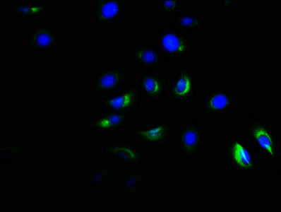 Acvr1B Polyclonal Antibody - image 2