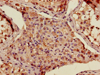 Adamts12 Polyclonal Antibody - image 2