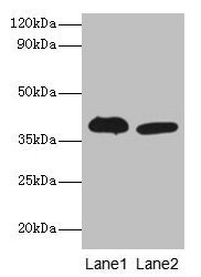 Adh5 Polyclonal Antibody - image 2