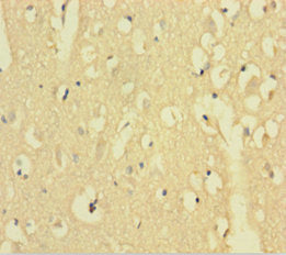 Aftph Polyclonal Antibody - image 2