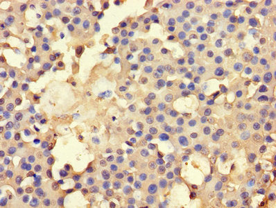 Ahcy Polyclonal Antibody - image 2