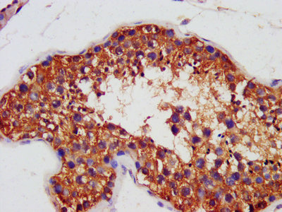 IHC image diluted at 1:1400 and staining in paraffin-embedded human kidney tissue performed on a Leica BondTM system. After dewaxing and hydration, antigen retrieval was mediated by high pressure in a citrate buffer (pH 6.0). Section was blocked with 10% normal goat serum 30min at RT. Then primary antibody (1% BSA) was incubated at 4°C overnight. The primary is detected by a biotinylated secondary antibody and visualized using an HRP conjugated SP system.