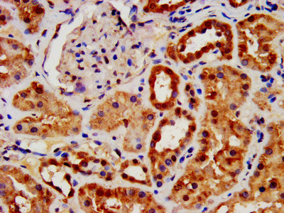 Immunofluorescence staining of HepG2 cells with CAC11738 at 1:466, counter-stained with DAPI. The cells were fixed in 4% formaldehyde, permeabilized using 0.2% Triton X-100 and blocked in 10% normal Goat Serum. The cells were then incubated with the antibody overnight at 4°C. The secondary antibody was Alexa Fluor 488-congugated AffiniPure Goat Anti-Rabbit IgG(H+L).