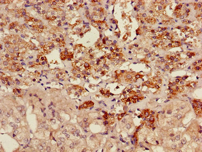 Immunohistochemistry of paraffin-embedded human heart tissue using CAC11740 at dilution of 1:100
