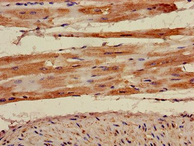 Immunofluorescence staining of HepG2 cells with CAC11740 at 1:120,counter-stained with DAPI. The cells were fixed in 4% formaldehyde, permeabilized using 0.2% Triton X-100 and blocked in 10% normal Goat Serum. The cells were then incubated with the antibody overnight at 4°C.The secondary antibody was Alexa Fluor 488-congugated AffiniPure Goat Anti-Rabbit IgG (H+L).