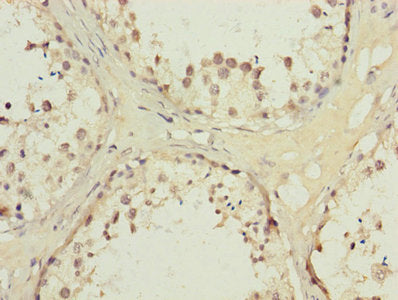 Immunohistochemistry of paraffin-embedded human liver tissue using CAC11741 at dilution of 1:100