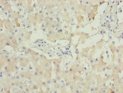 Akr1D1 Polyclonal Antibody - image 3