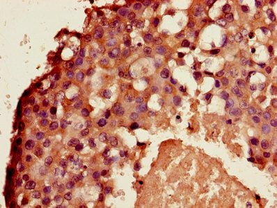 Aldh3B2 Polyclonal Antibody - image 3