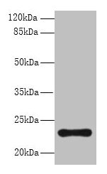 Ap3S2 Polyclonal Antibody - image 2