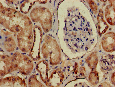 Arhgap25 Polyclonal Antibody - image 3