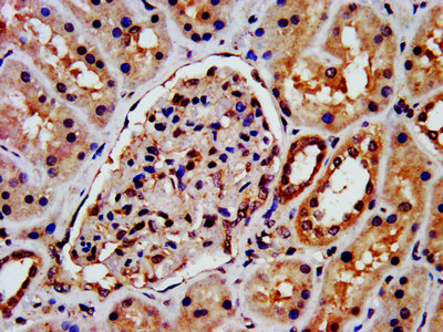 Immunofluorescence staining of HepG2 cells with CAC11753 at 1:233, counter-stained with DAPI. The cells were fixed in 4% formaldehyde, permeabilized using 0.2% Triton X-100 and blocked in 10% normal Goat Serum. The cells were then incubated with the antibody overnight at 4°C. The secondary antibody was Alexa Fluor 488-congugated AffiniPure Goat Anti-Rabbit IgG(H+L).