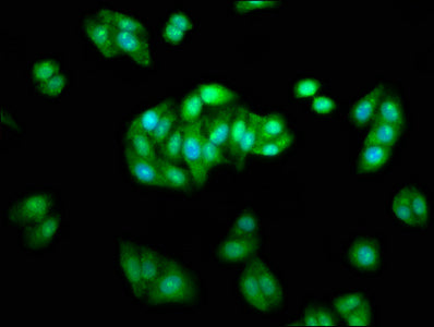 Arrb1 Polyclonal Antibody - image 4