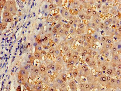 Immunofluorescence staining of Hela cells with CAC11756 at 1:100, counter-stained with DAPI. The cells were fixed in 4% formaldehyde, permeabilized using 0.2% Triton X-100 and blocked in 10% normal Goat Serum. The cells were then incubated with the antibody overnight at 4°C. The secondary antibody was Alexa Fluor 488-congugated AffiniPure Goat Anti-Rabbit IgG(H+L).