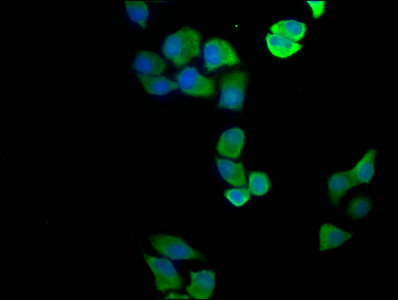 Asl Polyclonal Antibody - image 4
