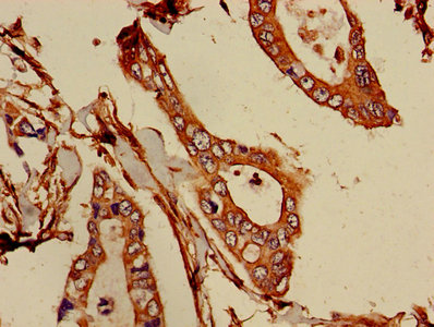 Immunofluorescent analysis of Hela cells using CAC11757 at dilution of 1:100 and Alexa Fluor 488-congugated AffiniPure Goat Anti-Rabbit IgG(H+L)