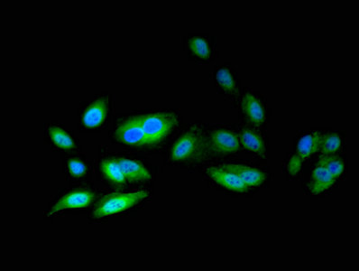 Atic Polyclonal Antibody - image 5