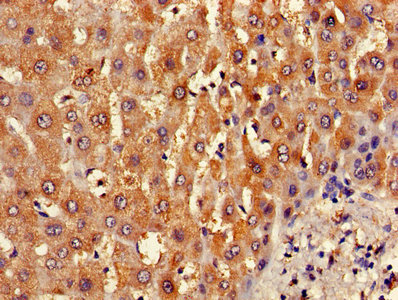 Immunohistochemistry of paraffin-embedded human heart tissue using CAC11760 at dilution of 1:100