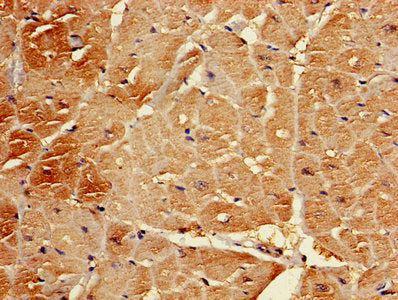 Immunofluorescence staining of A549 cells with CAC11760 at 1:133, counter-stained with DAPI. The cells were fixed in 4% formaldehyde, permeabilized using 0.2% Triton X-100 and blocked in 10% normal Goat Serum. The cells were then incubated with the antibody overnight at 4°C. The secondary antibody was Alexa Fluor 488-congugated AffiniPure Goat Anti-Rabbit IgG(H+L).