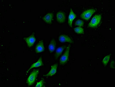 B3Galt2 Polyclonal Antibody - image 4