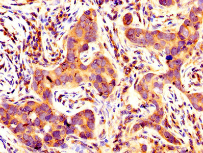 Immunofluorescence staining of MCF-7 cells with CAC11764 at 1:133, counter-stained with DAPI. The cells were fixed in 4% formaldehyde, permeabilized using 0.2% Triton X-100 and blocked in 10% normal Goat Serum. The cells were then incubated with the antibody overnight at 4°C. The secondary antibody was Alexa Fluor 488-congugated AffiniPure Goat Anti-Rabbit IgG(H+L).
