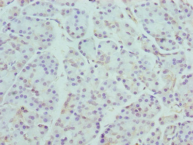 Ccr4 Polyclonal Antibody - image 3