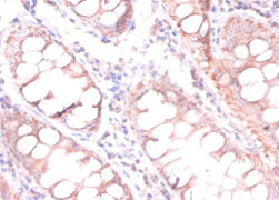 Cdkn2Aipnl Polyclonal Antibody - image 3