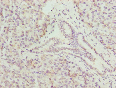 Cmc1 Polyclonal Antibody - image 3