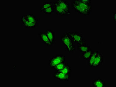 Cygb Polyclonal Antibody - image 3