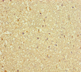 Immunohistochemistry of paraffin-embedded human pancreatic tissue using CAC11828 at dilution of 1:100