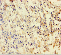 Immunofluorescent analysis of Hela cells using CAC11829 at dilution of 1:100 and Alexa Fluor 488-congugated AffiniPure Goat Anti-Rabbit IgG(H+L)