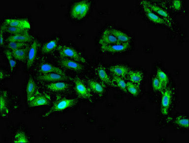 Dhfr Polyclonal Antibody - image 3
