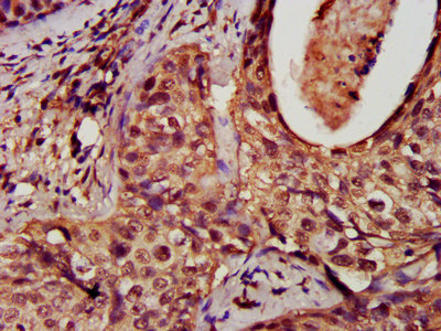 Immunohistochemistry analysis of human brain tissue using CAC11832 at dilution of 1:100
