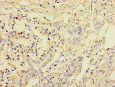 Fosl2 Polyclonal Antibody - image 3