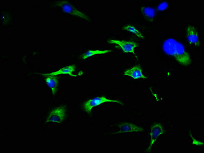 Immunohistochemistry of paraffin-embedded human cervical cancer using CAC11861 at dilution of 1:100
