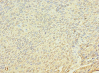 Immunohistochemistry of paraffin-embedded human skin tissue using CAC11861 at dilution of 1:100