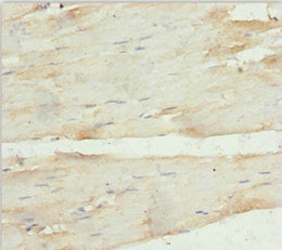 ANKRD1 Polyclonal Antibody - image 3
