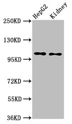 IHC image of CAC12816 diluted at 1:300 and staining in paraffin-embedded human small intestine tissue performed on a Leica BondTM system. After dewaxing and hydration, antigen retrieval was mediated by high pressure in a citrate buffer (pH 6.0). Section was blocked with 10% normal goat serum 30min at RT. Then primary antibody (1% BSA) was incubated at 4°C overnight. The primary is detected by a biotinylated secondary antibody and visualized using an HRP conjugated SP system.