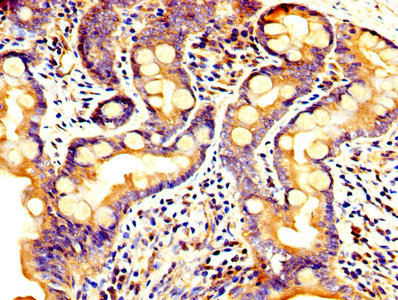 PCSK5 Polyclonal Antibody - image 4