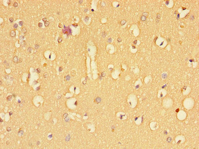 Immunohistochemistry of paraffin-embedded human placenta tissue using CAC12817 at dilution of 1:100