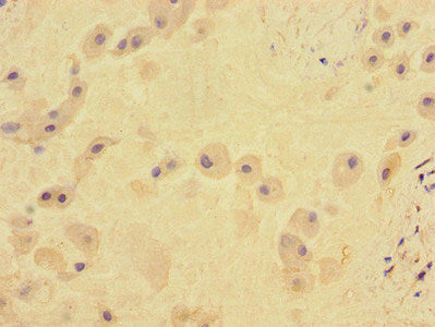Immunofluorescent analysis of MCF-7 cells using CAC12817 at dilution of 1:100 and Alexa Fluor 488-congugated AffiniPure Goat Anti-Rabbit IgG(H+L)