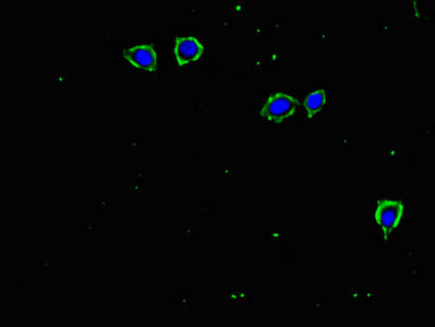 TGFBR2 Polyclonal Antibody - image 4