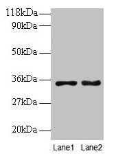 Immunohistochemistry of paraffin-embedded human liver tissue using CAC12824 at dilution of 1:100