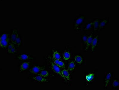 PTDSS1 Polyclonal Antibody - image 4