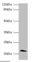 Immunohistochemistry of paraffin-embedded human cervical cancer using CAC12837 at dilution of 1:100
