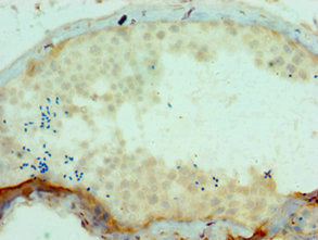 SSX2 Polyclonal Antibody - image 4