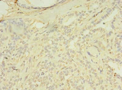 Immunohistochemistry of paraffin-embedded human small intestine tissue using CAC12840 at dilution of 1:100